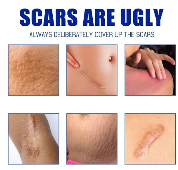 Scar Removal Cream 30g – Advanced Scar Repair Cream for Face & Body | Pack of 1